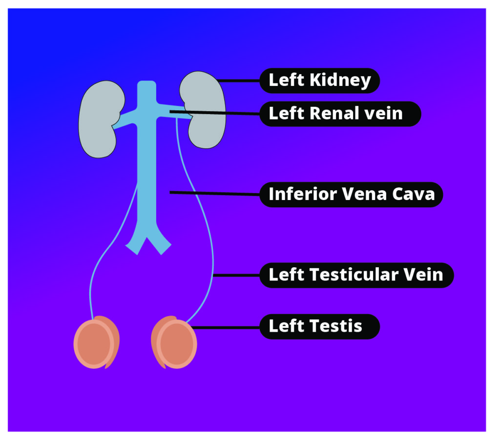left testicular vein drains to left renal vein-01