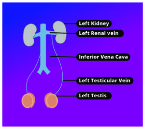 Varicocele and Infertility: Complete Guide for men. - Alltesticles.com