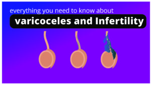 Varicocele and Infertility: Complete Guide for men.