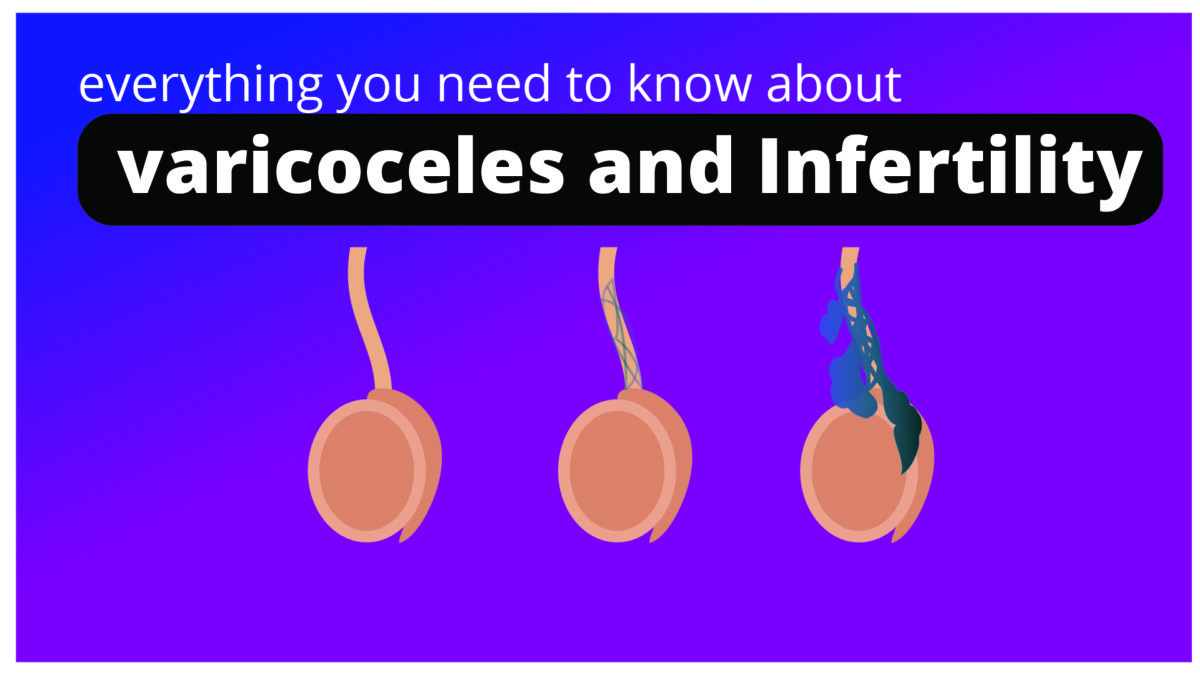 Varicocele and Infertility: Complete Guide for men.