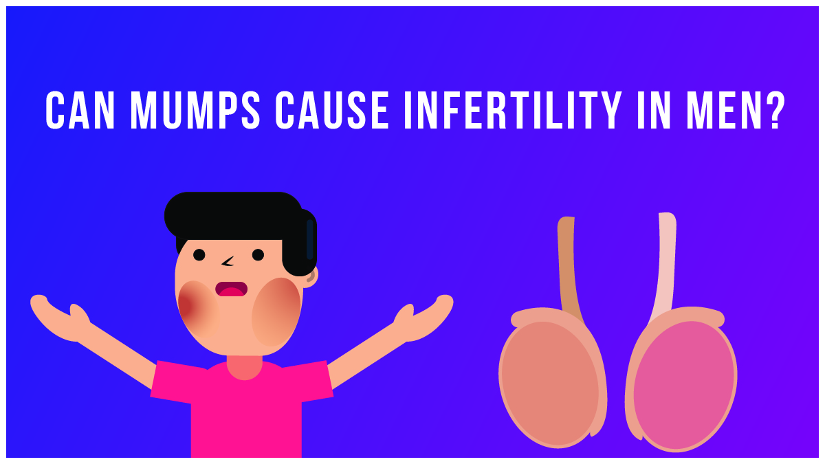 Can mumps cause infertility in men? Only in these situations.