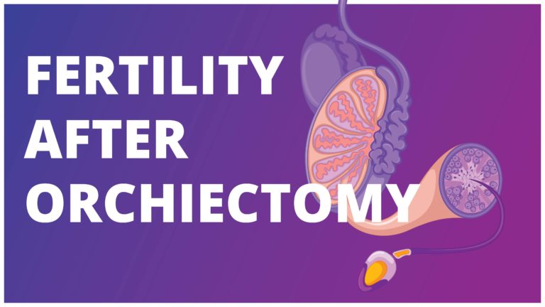 Fertility after Orchiectomy: Effects of surgery, Chemotherapy and